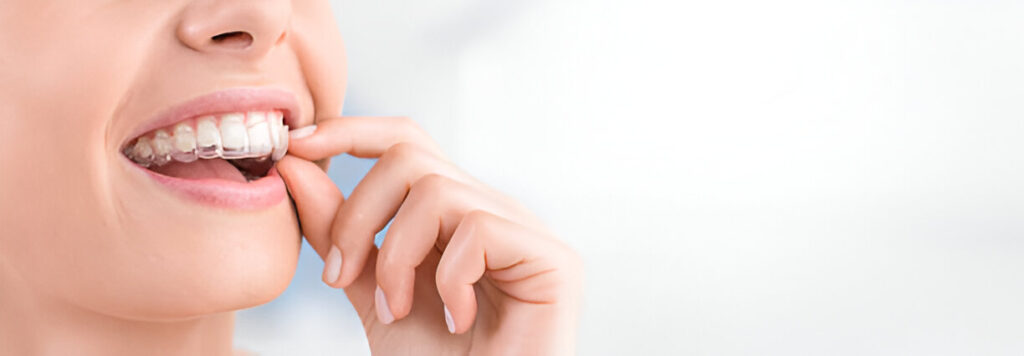 Oral Health and Smile